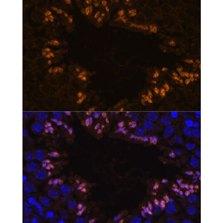 Immunofluorescence - Anti-ELSPBP1 Antibody (A88952) - Antibodies.com