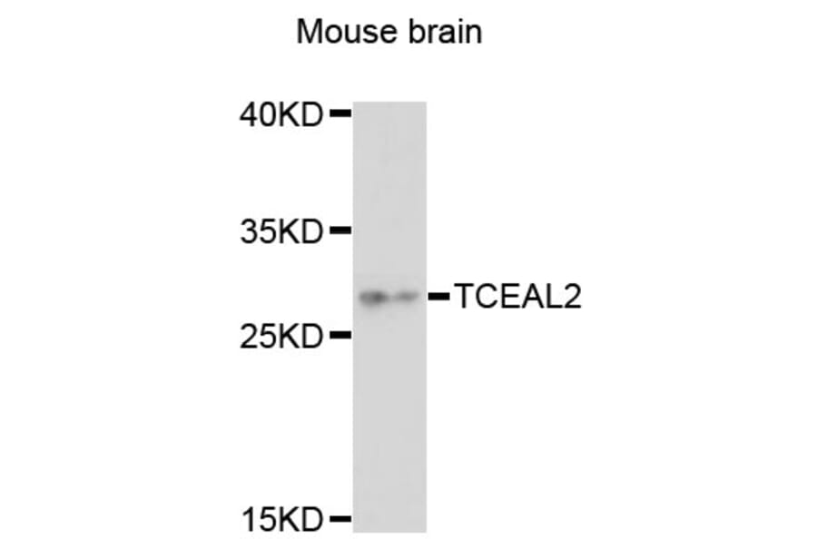 Western Blot - Anti-TCEAL2 Antibody (A13184) - Antibodies.com
