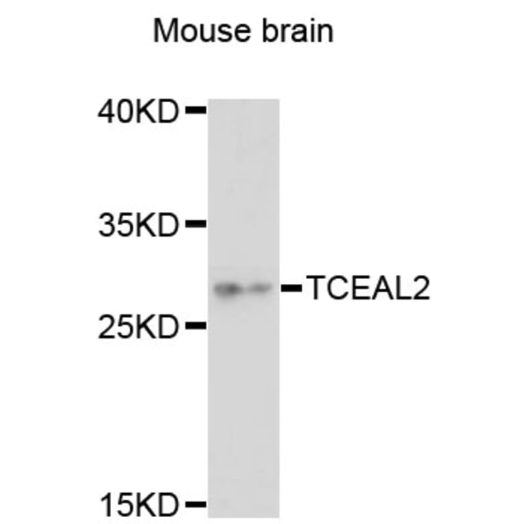 Western Blot - Anti-TCEAL2 Antibody (A13184) - Antibodies.com