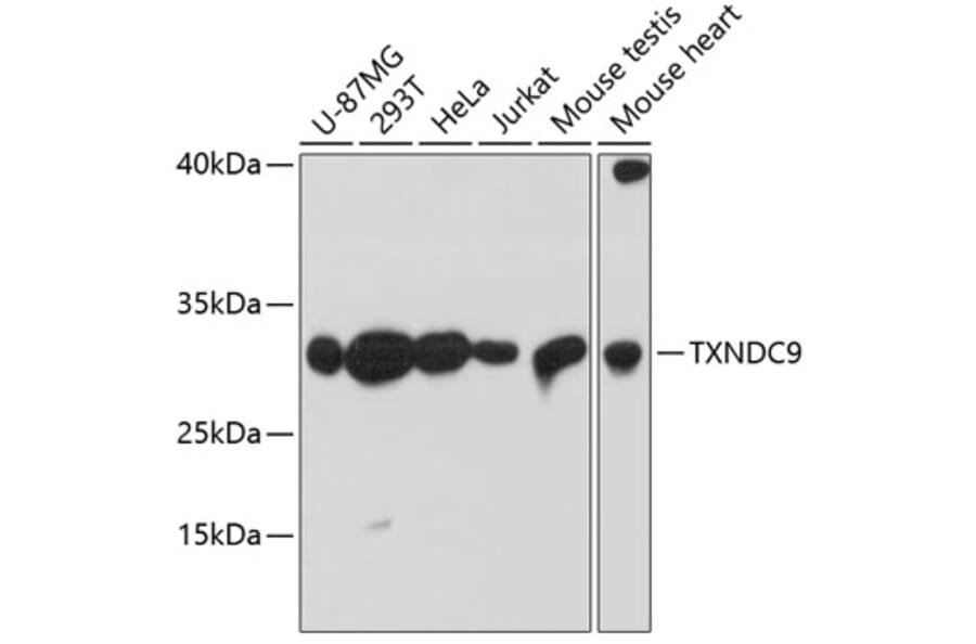 Western Blot - Anti-TXNDC9 Antibody (A88954) - Antibodies.com