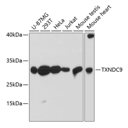 Western Blot - Anti-TXNDC9 Antibody (A88954) - Antibodies.com