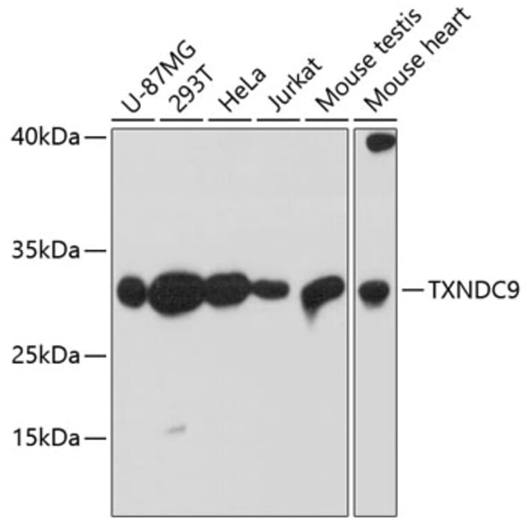 Western Blot - Anti-TXNDC9 Antibody (A88954) - Antibodies.com