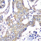 Immunohistochemistry - Anti-TXNDC9 Antibody (A88954) - Antibodies.com