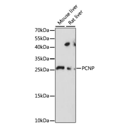 Western Blot - Anti-PCNP Antibody (A88955) - Antibodies.com