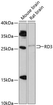 Western blot analysis of extracts of various cell lines, using Anti-RD3 Antibody (A13165) at 1:1,000 dilution.
Secondary antibody: Goat Anti-Rabbit IgG (H+L) (HRP) (AS014) at 1:10,000 dilution.
Lysates / proteins: 25µg per lane.
Blocking buffer: 3% non-fat dry milk in TBST.
Detection: ECL Enhanced Kit (RM00021).
Exposure time: 90s.