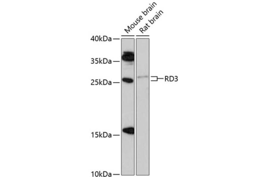 Western Blot - Anti-RD3 Antibody (A88956) - Antibodies.com