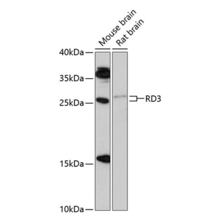 Western Blot - Anti-RD3 Antibody (A88956) - Antibodies.com