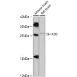Western Blot - Anti-RD3 Antibody (A88956) - Antibodies.com