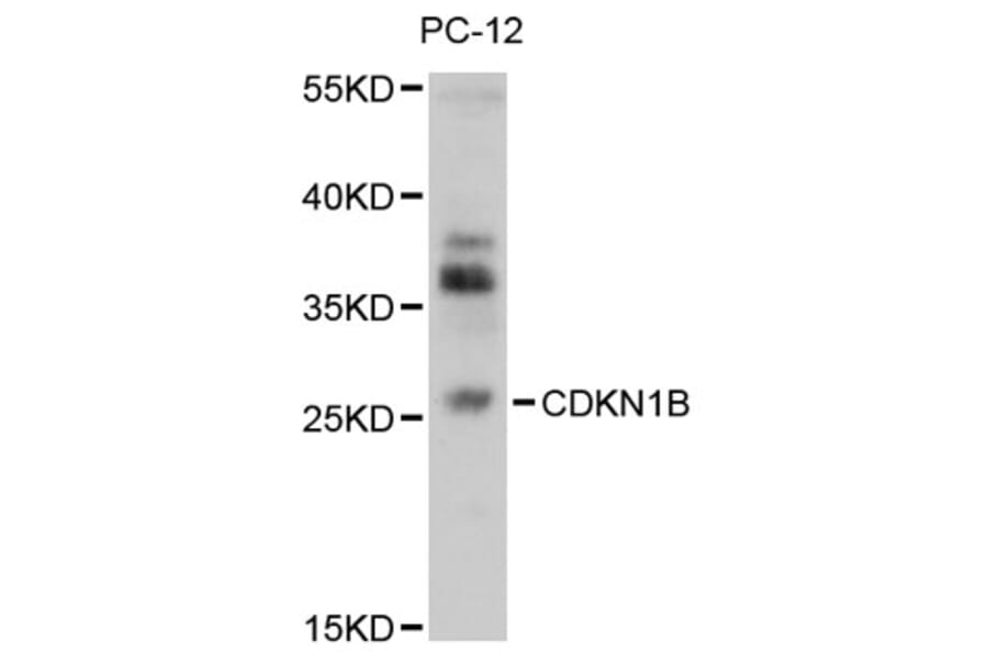 Western Blot - Anti-CDKN1B Antibody (A13613) - Antibodies.com