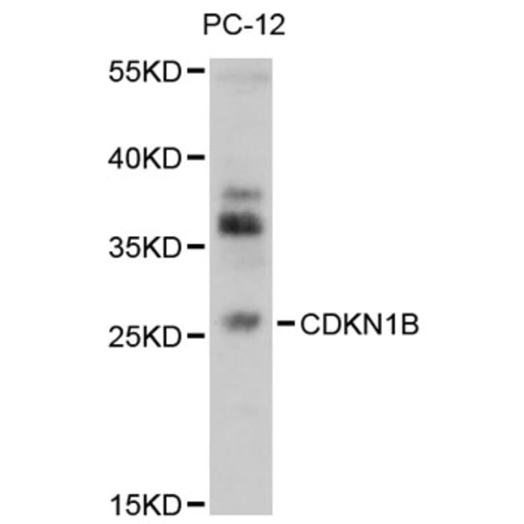 Western Blot - Anti-CDKN1B Antibody (A13613) - Antibodies.com