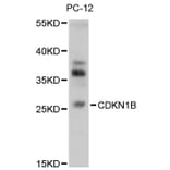 Western Blot - Anti-CDKN1B Antibody (A13613) - Antibodies.com