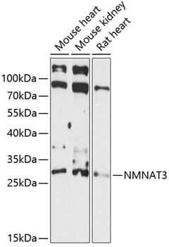 Western blot analysis of extracts of various cell lines, using Anti-NMNAT3 Antibody (A14465) at 1:3000 dilution.
Secondary antibody: Goat Anti-Rabbit IgG (H+L) (HRP) (AS014) at 1:10,000 dilution.
Lysates / proteins: 25µg per lane.
Blocking buffer: 3% non-fat dry milk in TBST.
Detection: ECL Basic Kit (RM00020).
Exposure time: 90s.