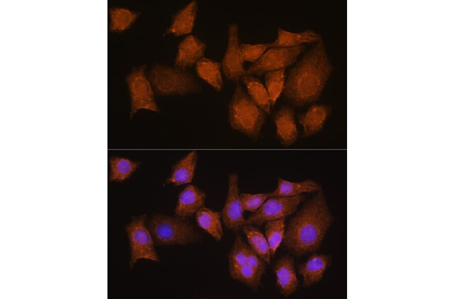 Immunofluorescence - Anti-NMNAT3 Antibody (A88959) - Antibodies.com