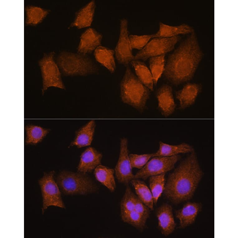 Immunofluorescence - Anti-NMNAT3 Antibody (A88959) - Antibodies.com