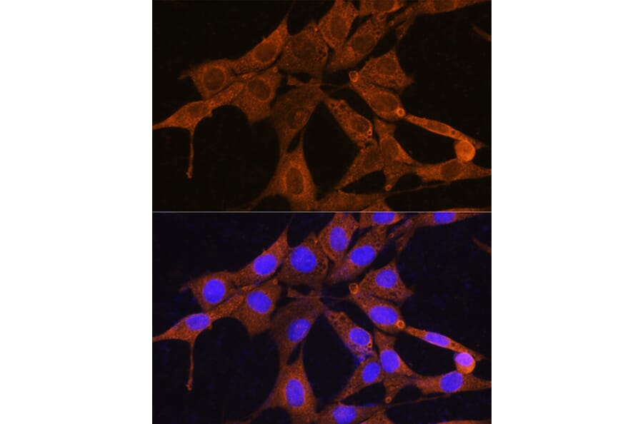 Immunofluorescence - Anti-NMNAT3 Antibody (A88959) - Antibodies.com