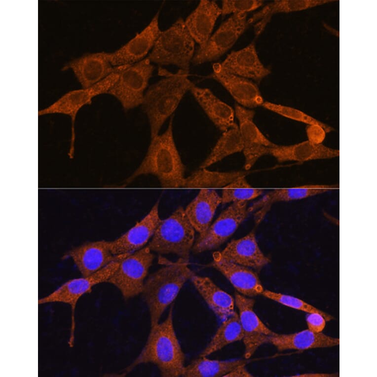 Immunofluorescence - Anti-NMNAT3 Antibody (A88959) - Antibodies.com
