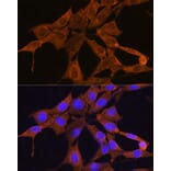 Immunofluorescence - Anti-NMNAT3 Antibody (A88959) - Antibodies.com
