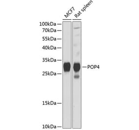 Western Blot - Anti-RPP29 Antibody (A88960) - Antibodies.com