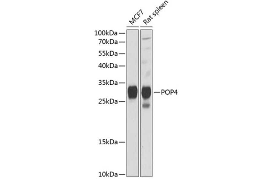 Western Blot - Anti-RPP29 Antibody (A88960) - Antibodies.com