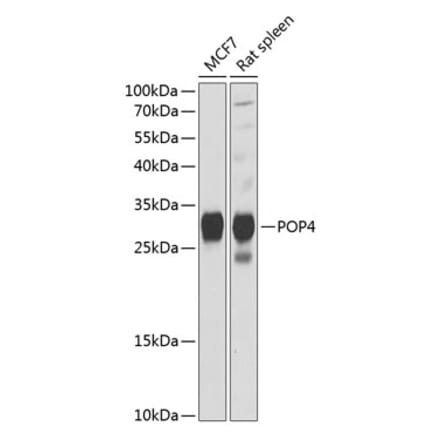 Western Blot - Anti-RPP29 Antibody (A88960) - Antibodies.com