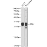 Western Blot - Anti-RPP29 Antibody (A88960) - Antibodies.com