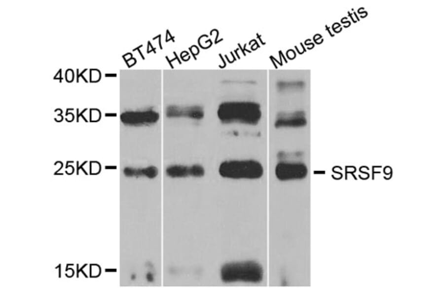 Western Blot - Anti-SFRS9 Antibody (A6070) - Antibodies.com