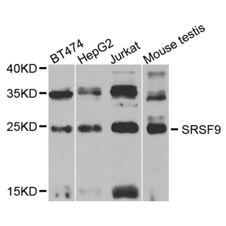 Western Blot - Anti-SFRS9 Antibody (A6070) - Antibodies.com