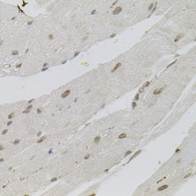 Immunohistochemistry - Anti-SFRS9 Antibody (A6070) - Antibodies.com