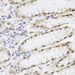 Immunohistochemistry - Anti-SFRS9 Antibody (A6070) - Antibodies.com