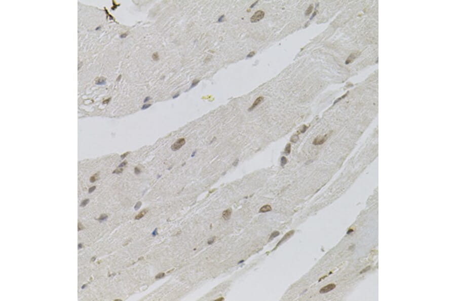 Immunohistochemistry - Anti-SFRS9 Antibody (A6070) - Antibodies.com