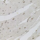 Immunohistochemistry - Anti-SFRS9 Antibody (A6070) - Antibodies.com
