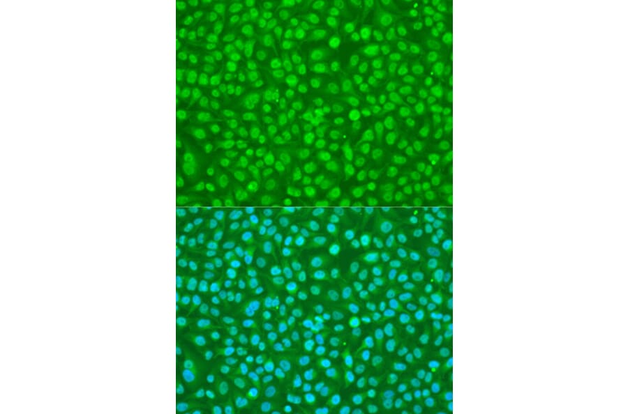 Immunofluorescence - Anti-SFRS9 Antibody (A6070) - Antibodies.com