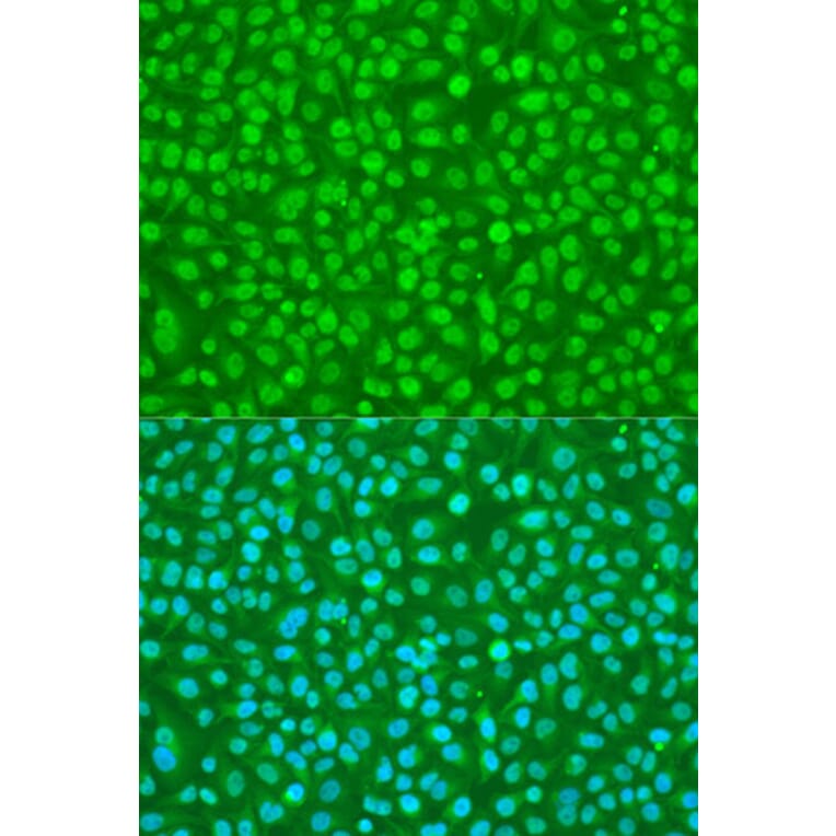 Immunofluorescence - Anti-SFRS9 Antibody (A6070) - Antibodies.com