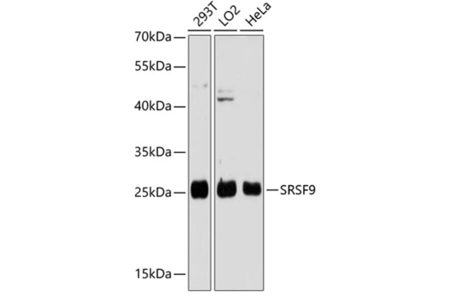 Western Blot - Anti-SFRS9 / SRSF9 Antibody (A88962) - Antibodies.com