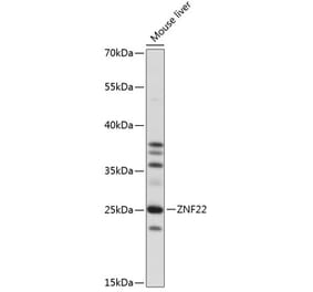 Western Blot - Anti-ZNF22 Antibody (A88963) - Antibodies.com