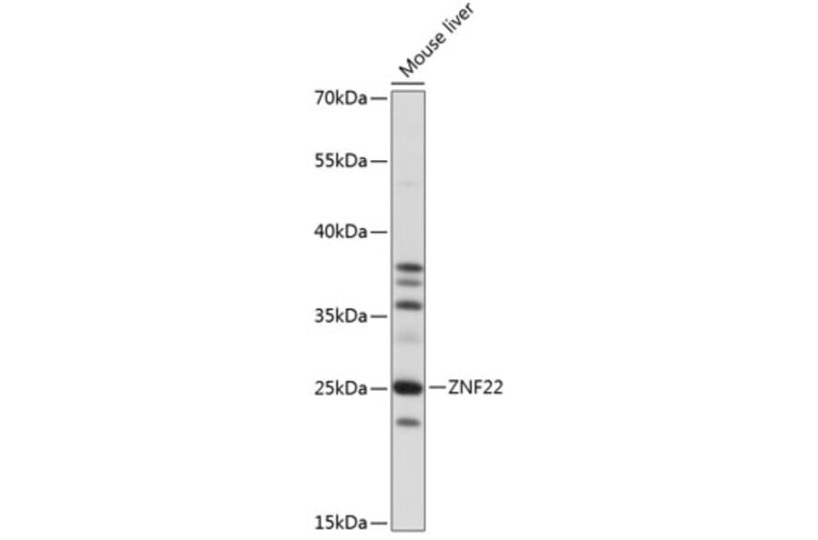 Western Blot - Anti-ZNF22 Antibody (A88963) - Antibodies.com