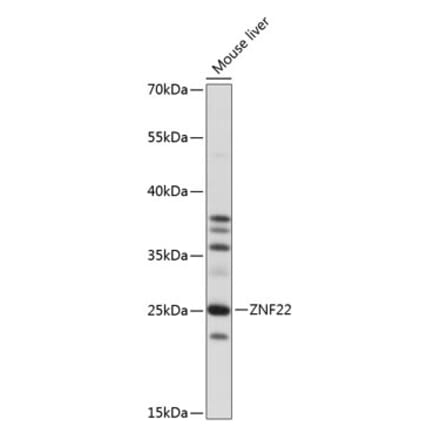 Western Blot - Anti-ZNF22 Antibody (A88963) - Antibodies.com