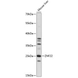 Western Blot - Anti-ZNF22 Antibody (A88963) - Antibodies.com