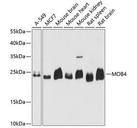 Western Blot - Anti-PREI3 Antibody (A88964) - Antibodies.com