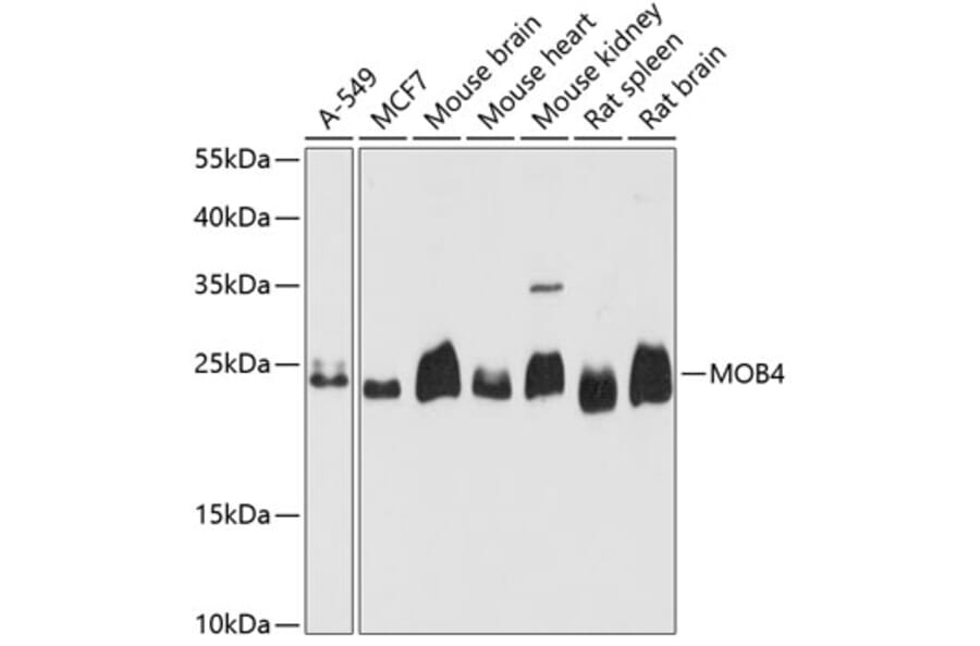 Western Blot - Anti-PREI3 Antibody (A88964) - Antibodies.com