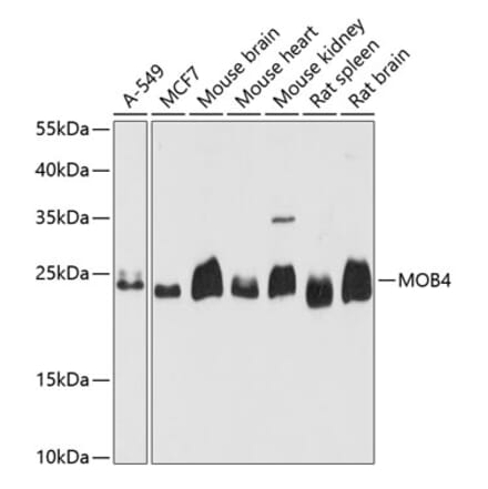 Western Blot - Anti-PREI3 Antibody (A88964) - Antibodies.com