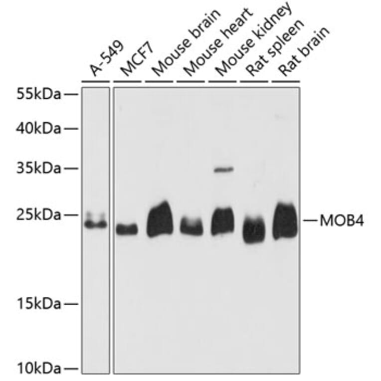 Western Blot - Anti-PREI3 Antibody (A88964) - Antibodies.com