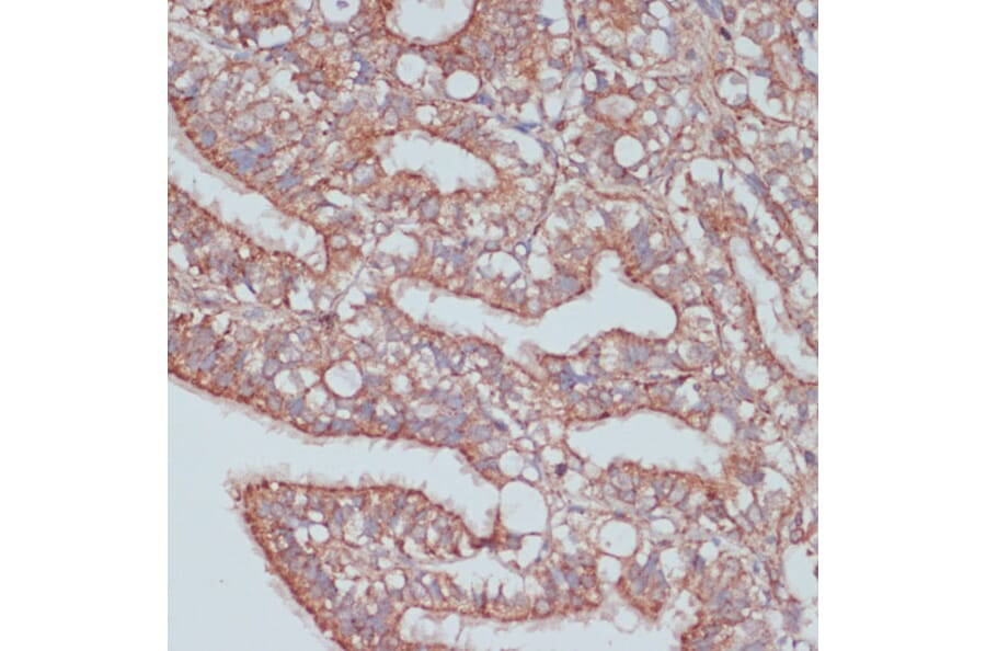 Immunohistochemistry - Anti-PREI3 Antibody (A88964) - Antibodies.com