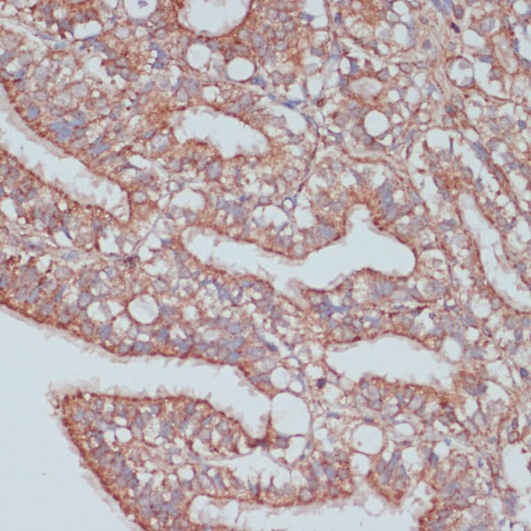 Immunohistochemistry - Anti-PREI3 Antibody (A88964) - Antibodies.com
