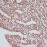 Immunohistochemistry - Anti-PREI3 Antibody (A88964) - Antibodies.com