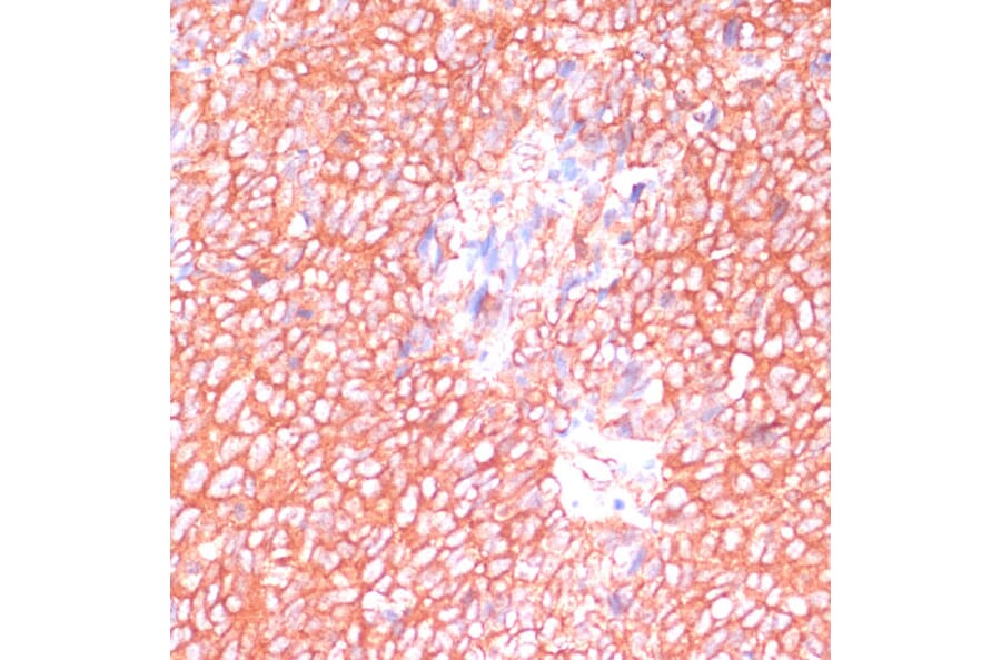 Immunohistochemistry - Anti-PREI3 Antibody (A88964) - Antibodies.com