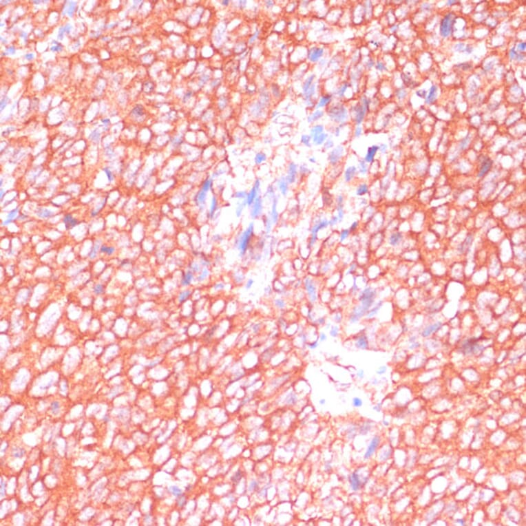 Immunohistochemistry - Anti-PREI3 Antibody (A88964) - Antibodies.com