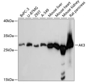 Western Blot - Anti-AK3 Antibody (A88965) - Antibodies.com