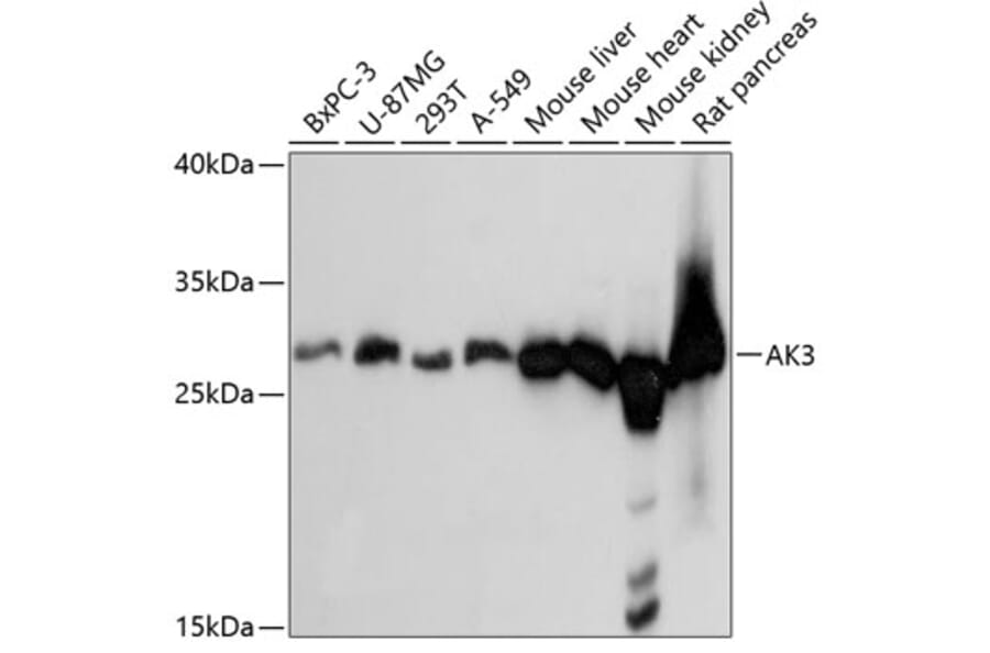 Western Blot - Anti-AK3 Antibody (A88965) - Antibodies.com