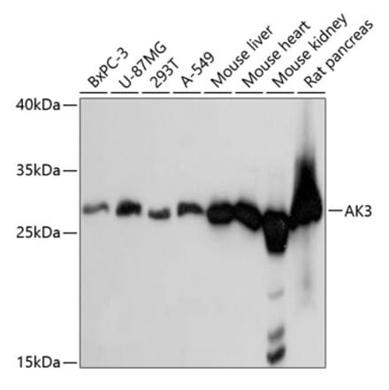 Western Blot - Anti-AK3 Antibody (A88965) - Antibodies.com